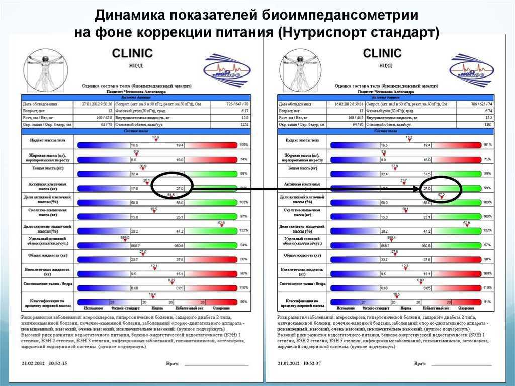 Что такое соотношение вкж окж