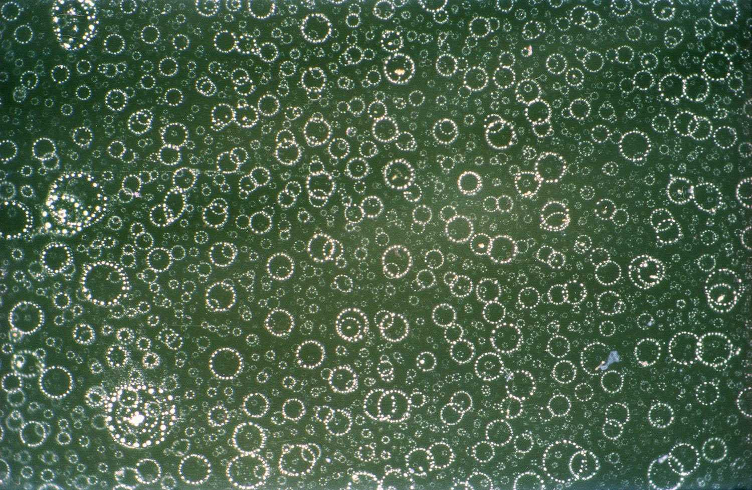 Кишечная палочка увидеть в микроскоп