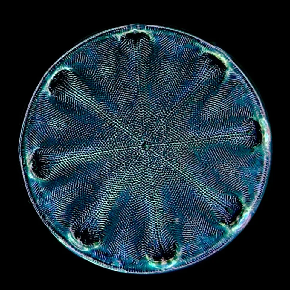 Как увидеть бактерии под микроскопом