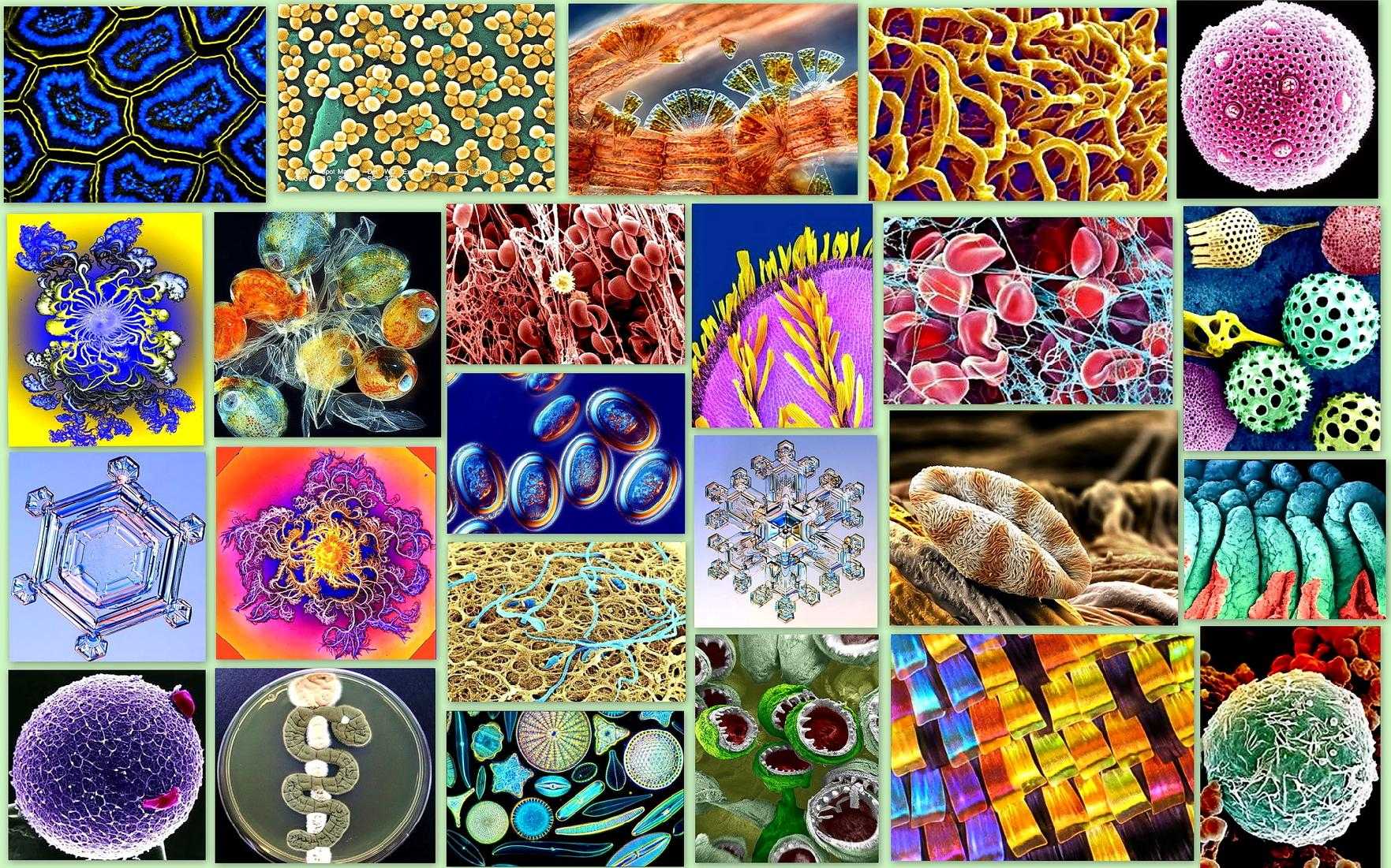 Какой микроскоп покажет бактерии? - quepaw