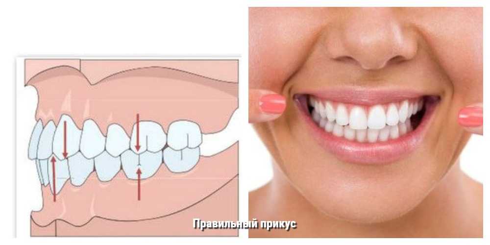 Длинные клыки у человека: значение и смысл