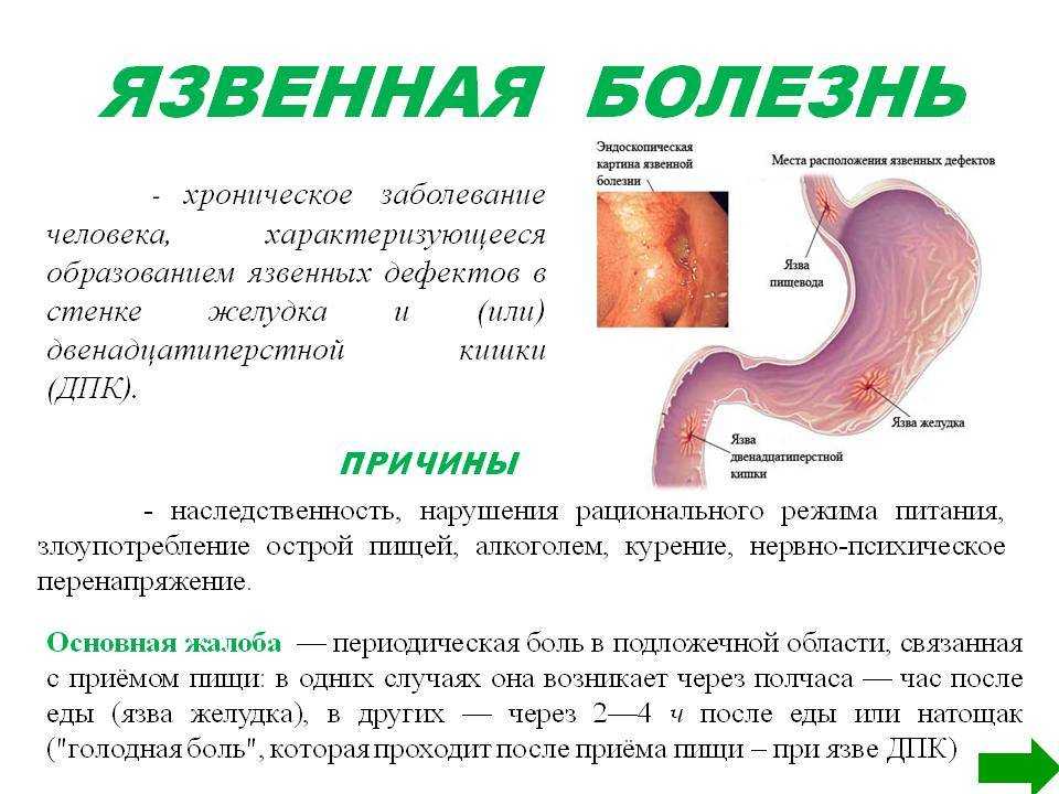 Виды сексуальных девиаций и причины их формирования