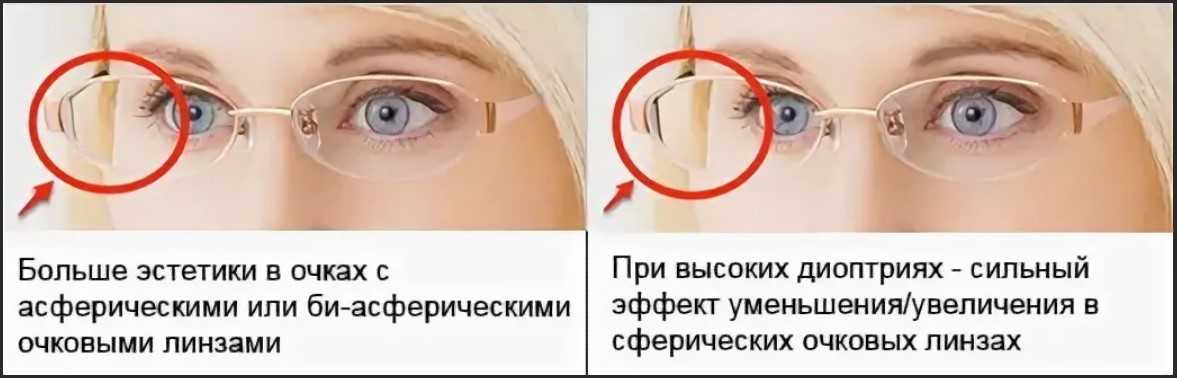 Что значит кривизна контактных линз