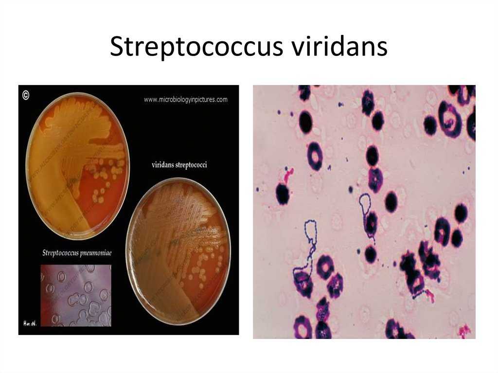 Streptococcus mitis (стрептококк митис): особенности, диагностика, лечение