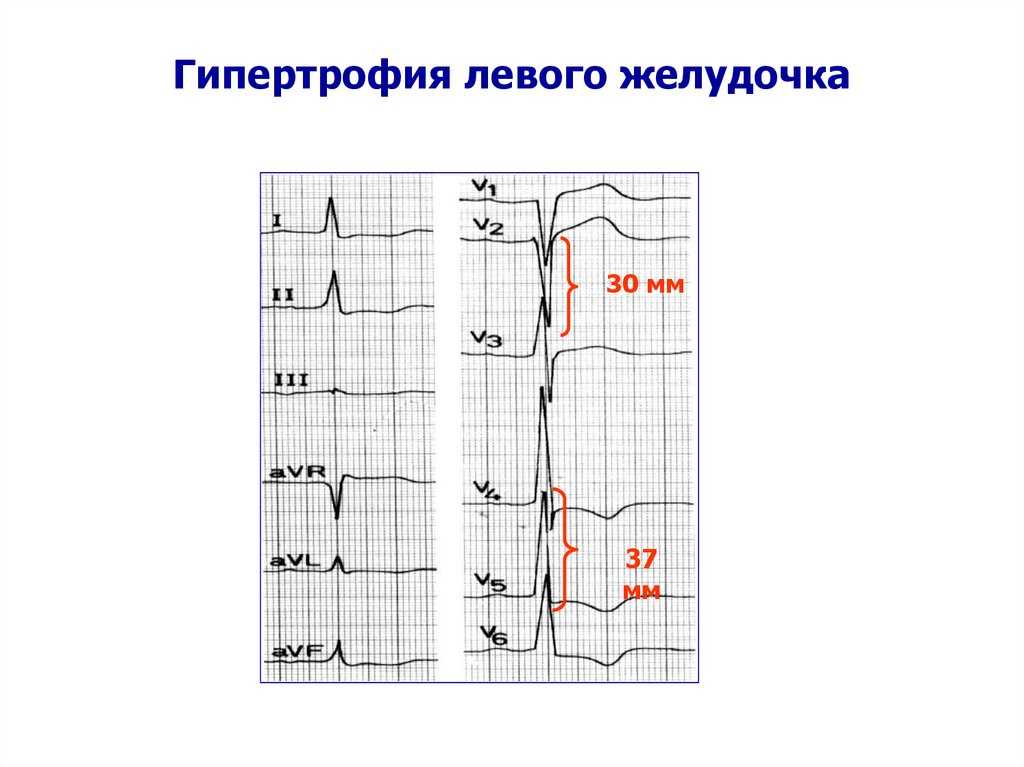 Общие вопросы безопасности жизнедеятельности. безопасность жизнедеятельности. курс лекций