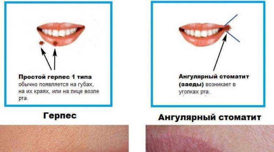 Почему чешется все тело без причины