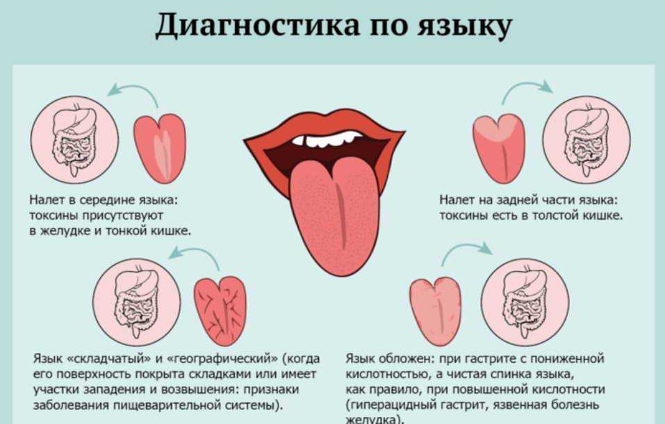 Три чулка с языка. сняли с языка как с языка снял
