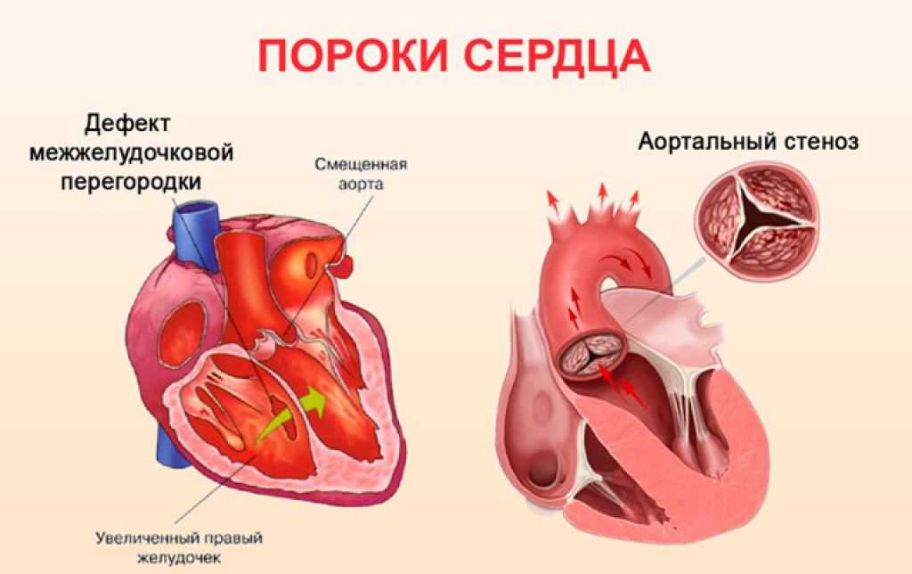 Главные пороки человека и методы, как с ними бороться. какие бывают пороки человека людские пороки