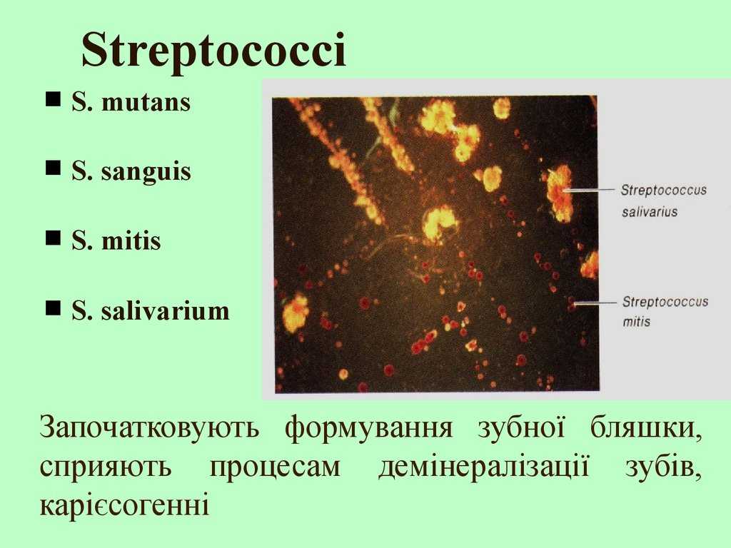 Инфекции, вызываемые streptococcus viridans (стрептококк вириданс) у взрослого - симптомы, лечение | фарингазон