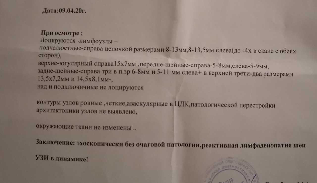Узи лимфатических узлов что показывает