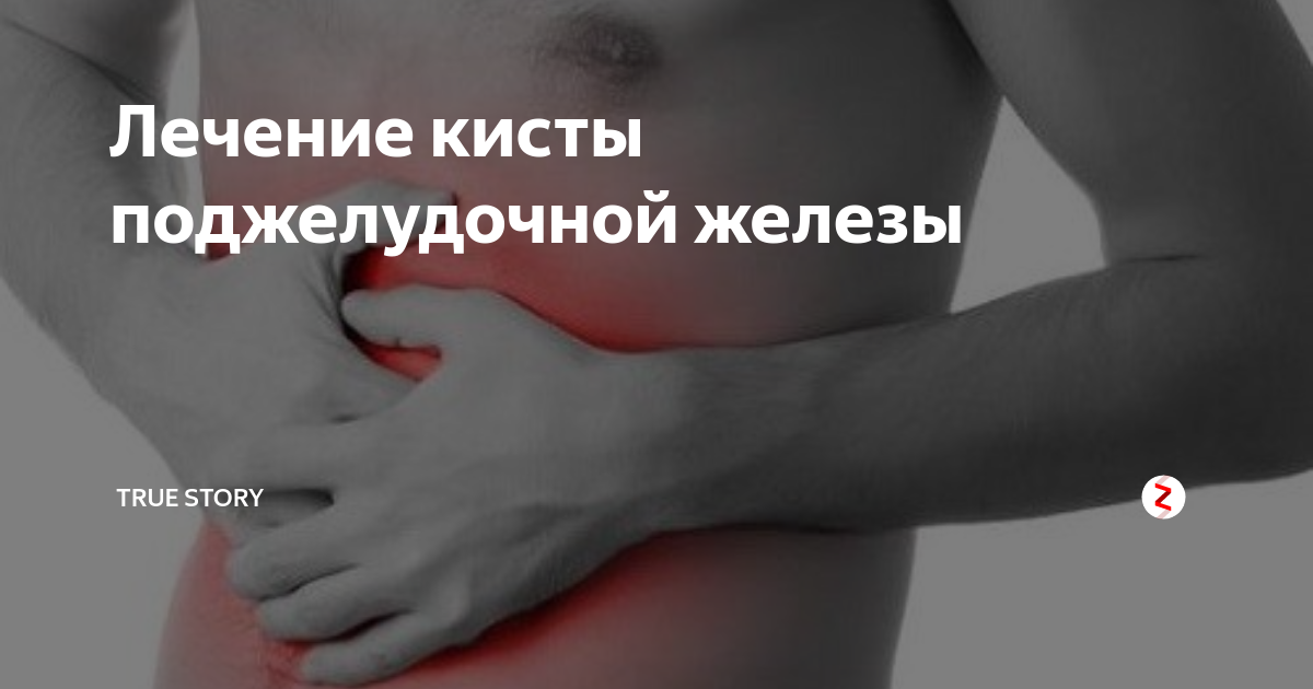 Вирсунгов проток расширен что это значит
