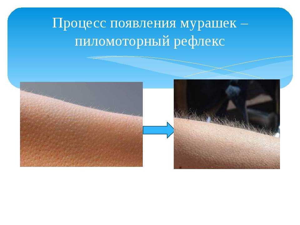 Что значит если мурашки по коже без причины приметы