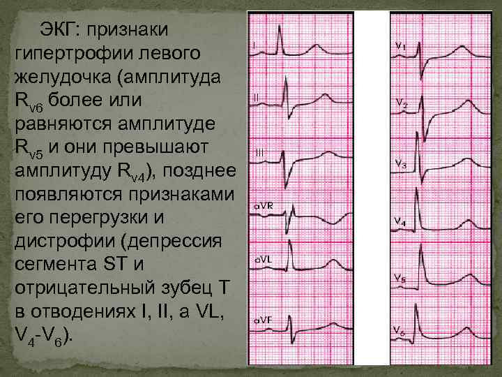 Гомогенное содержимое желчного пузыря: что означает этот медицинский термин