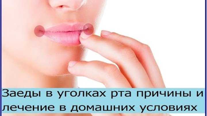 Зихте дрихте: всё, что вы хотели знать о данном феномене и его влиянии на здоровье