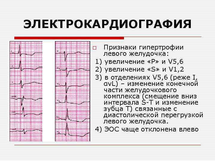 Анализ на лактатдегидрогеназу (лдг) — что означают показатели, какие заболевания или патологии помогает выявить — лаборатория анализытут