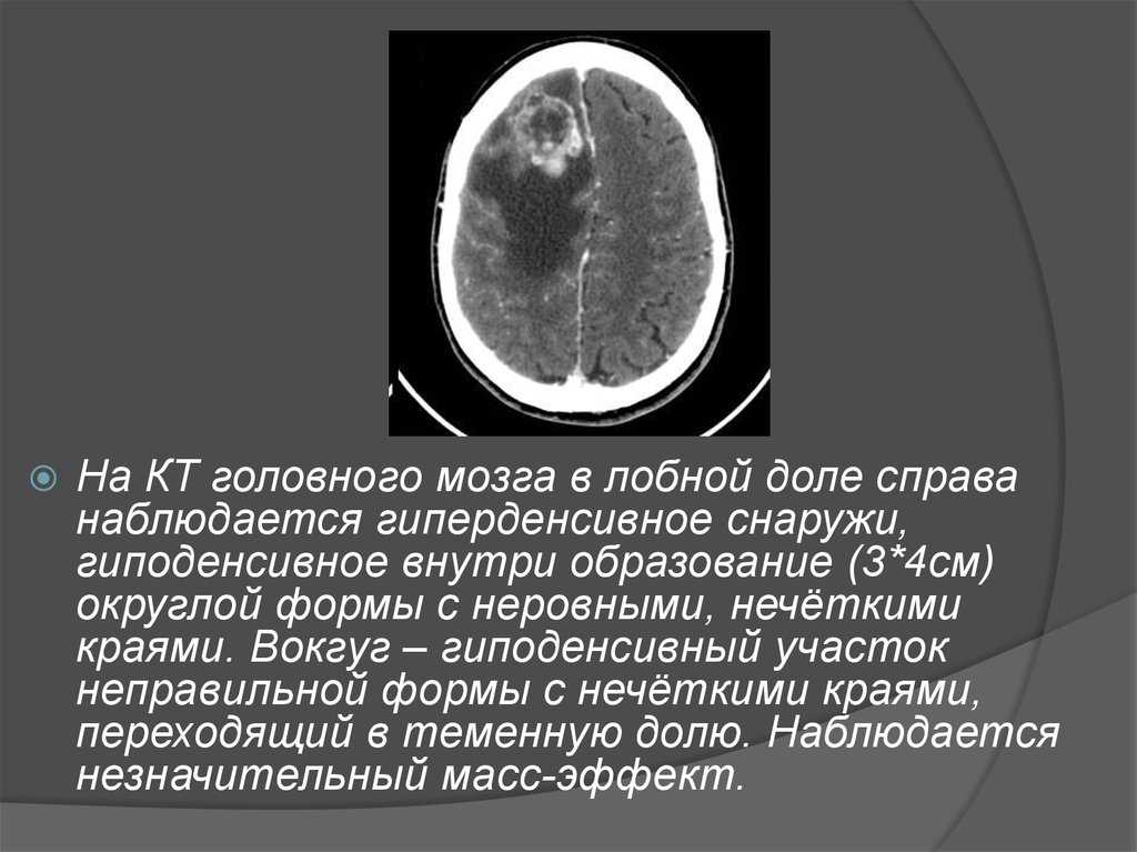 Узи почек для начинающих (лекция на диагностере) - диагностер