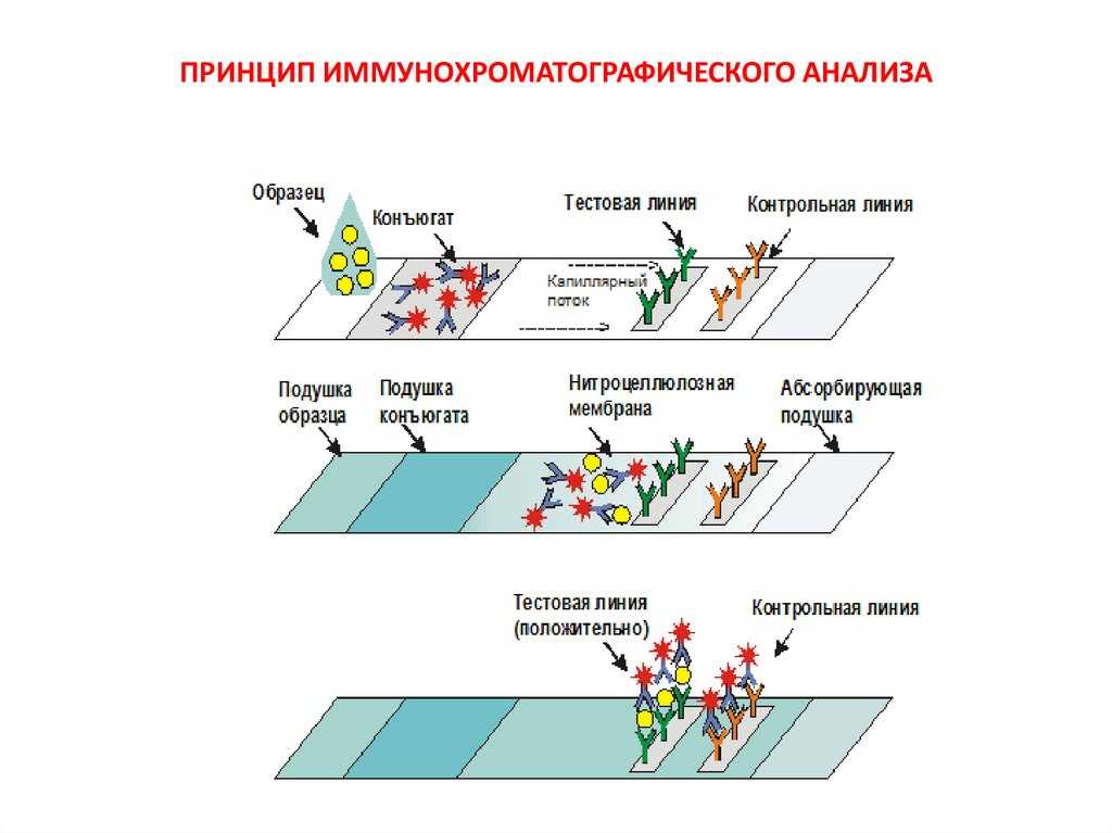 Использование иммунохроматографических тестов в алгоритме лабораторной диагностики гриппа » библиотека врача