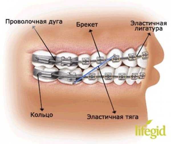 Что такое в шахматах доп 1 доп 2 доп 3